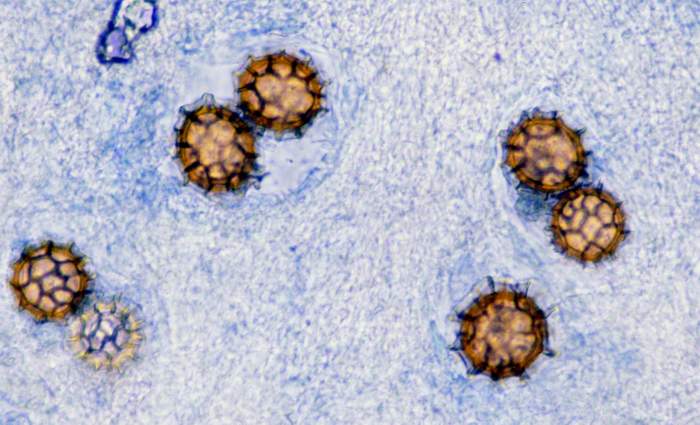 macrostoma