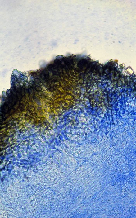 macrostoma