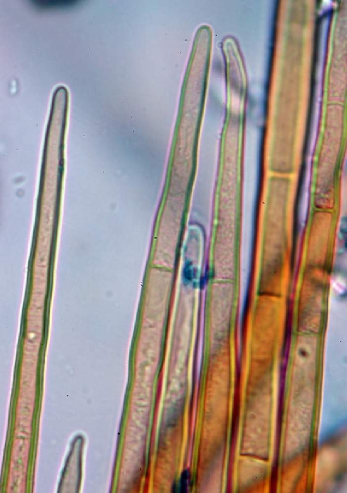 macrostoma
