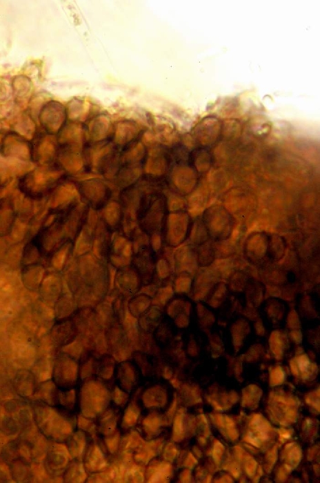 macrostoma