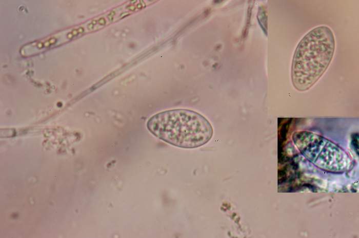 macrostoma