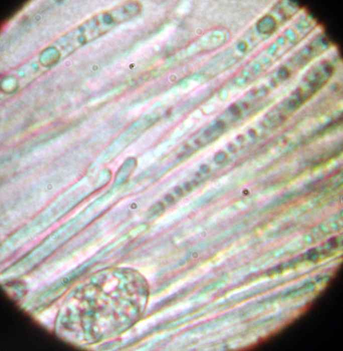 macrostoma