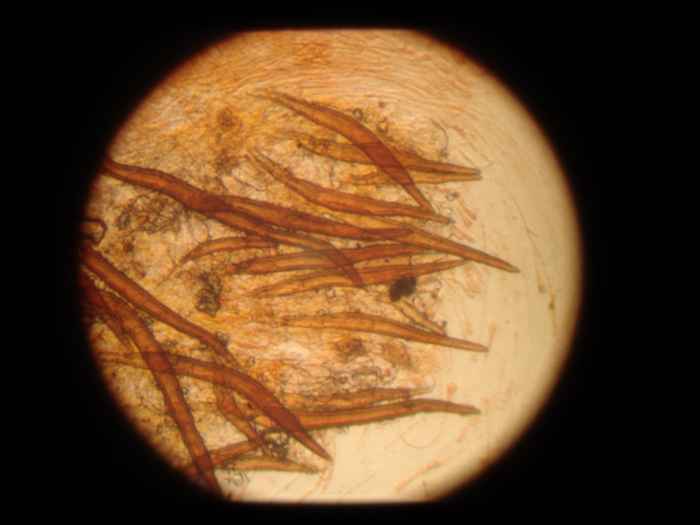 macrostoma
