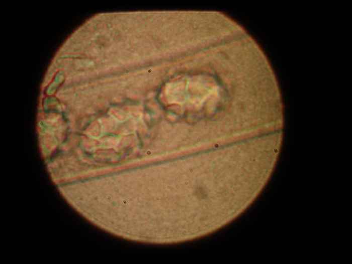 macrostoma