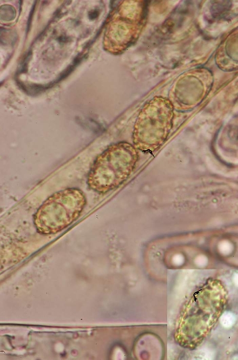 macrostoma