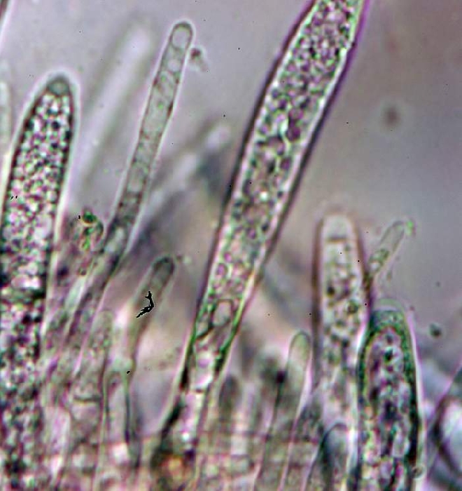 macrostoma