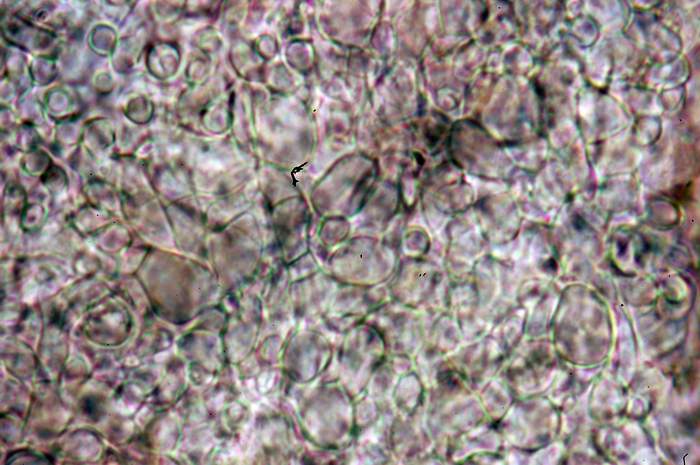 macrostoma
