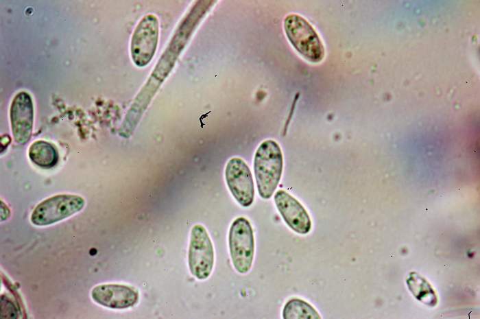 macrostoma