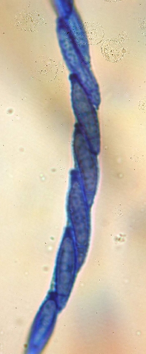macrostoma