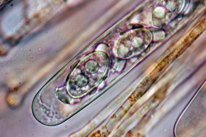 macrostoma