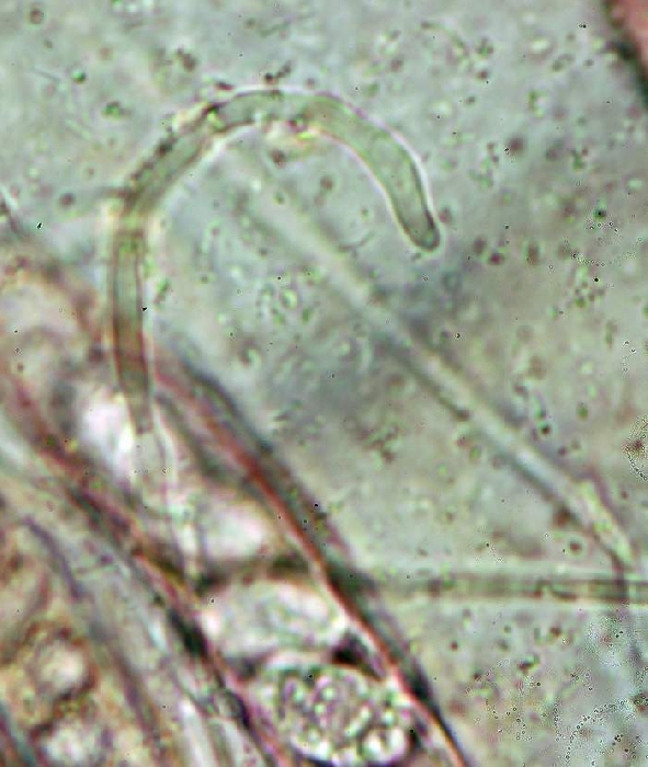 macrostoma