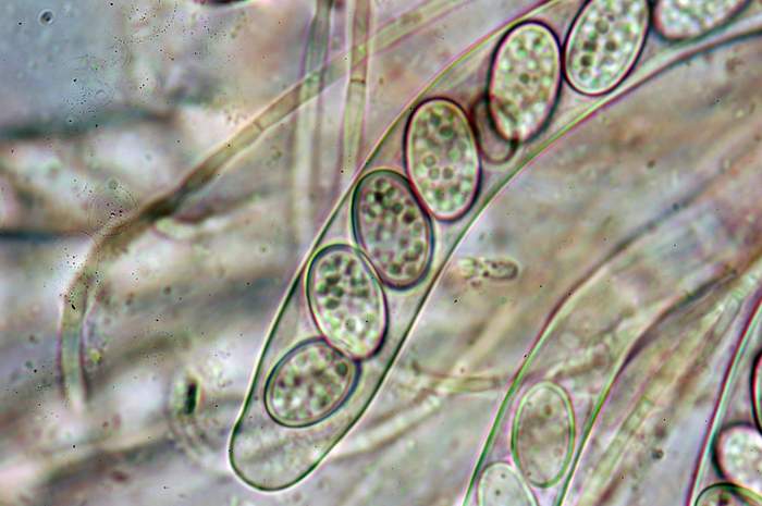 macrostoma