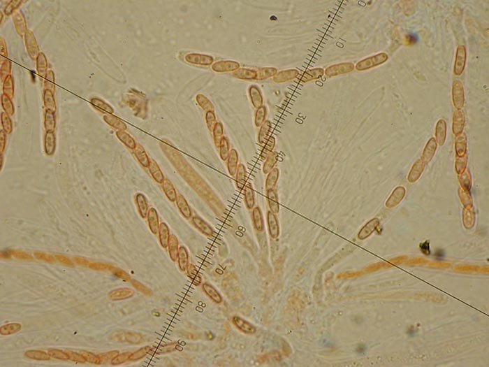 macrostoma