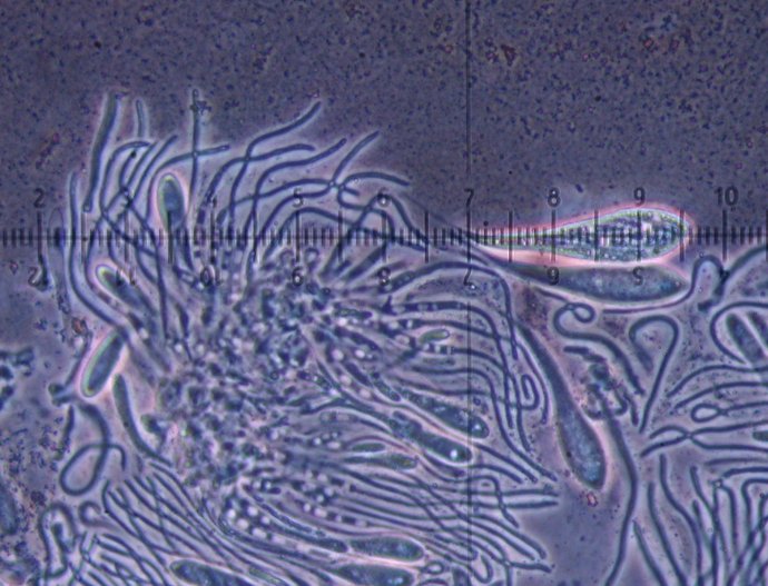 macrostoma