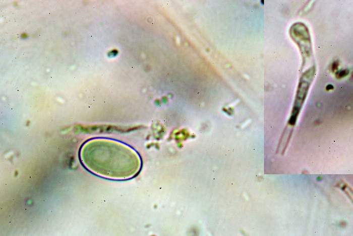 macrostoma