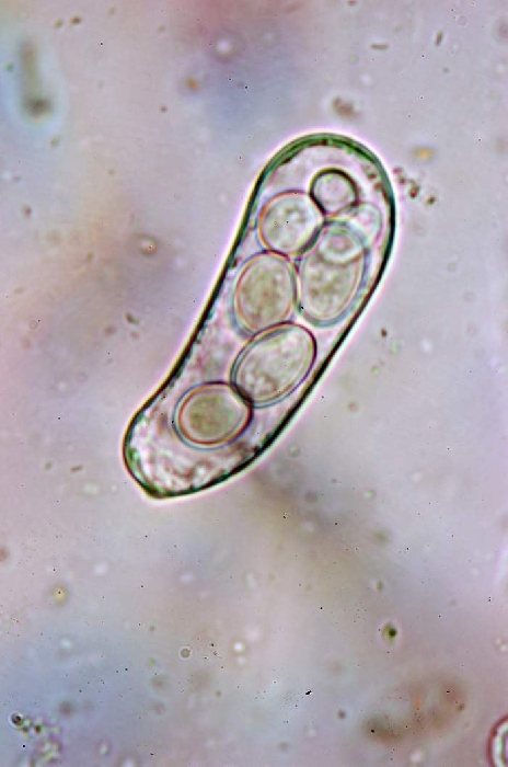 macrostoma