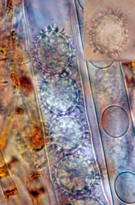 macrostoma