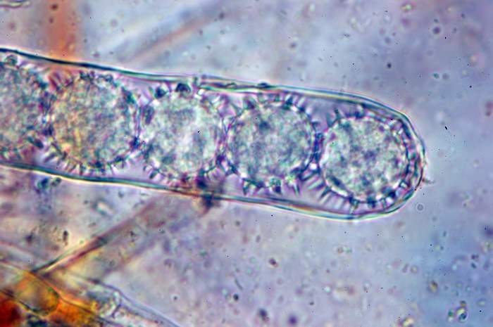 macrostoma