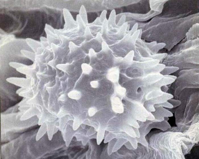 macrostoma