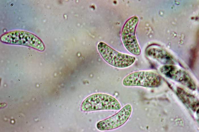 macrostoma