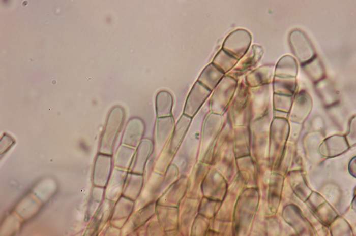 macrostoma