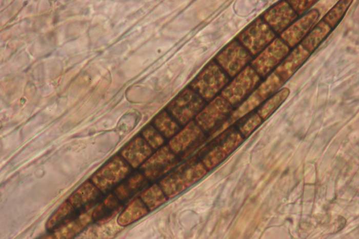 macrostoma