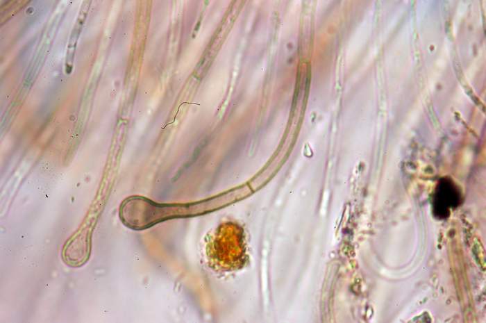 macrostoma