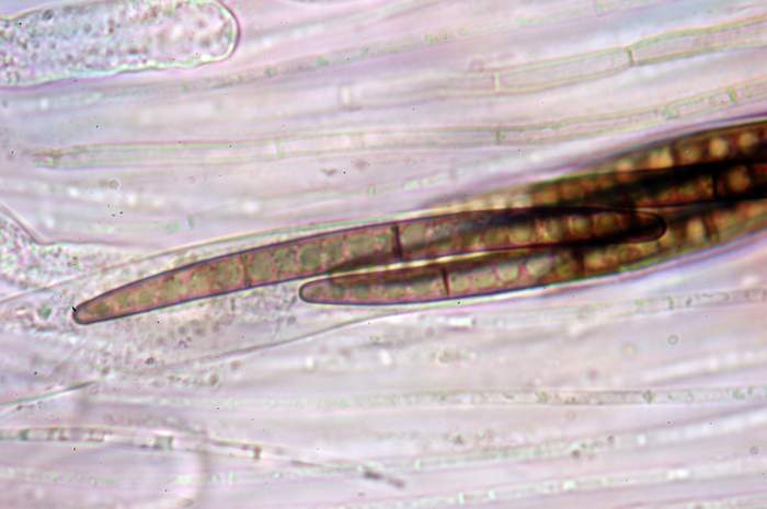 macrostoma