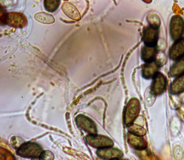 macrostoma