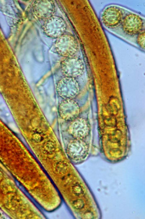 macrostoma