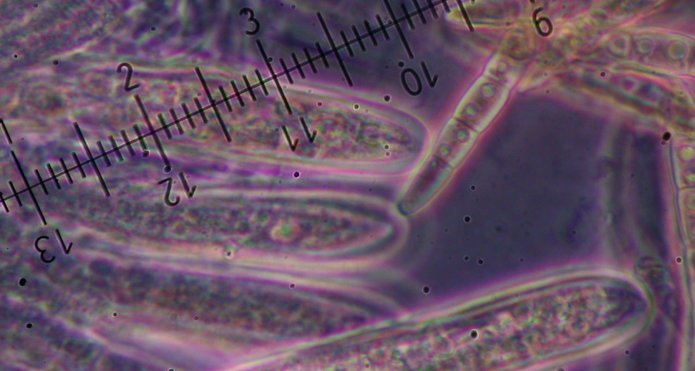 macrostoma