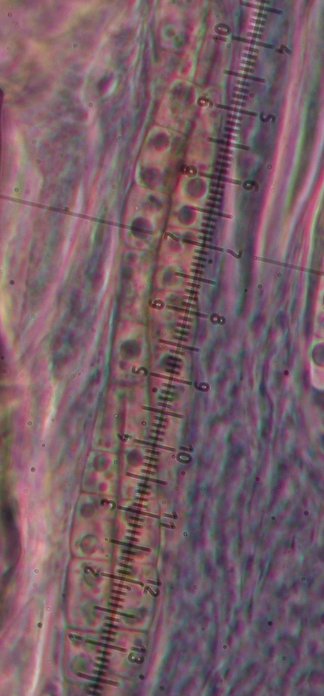 macrostoma