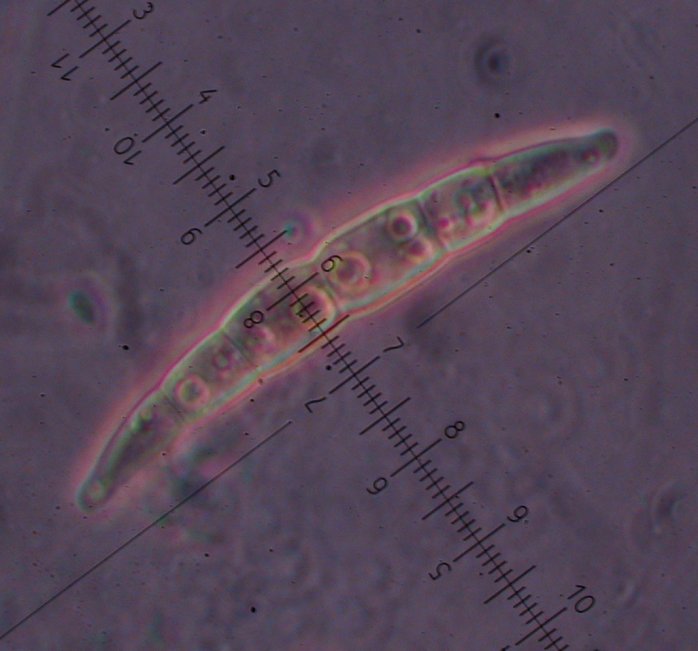 macrostoma