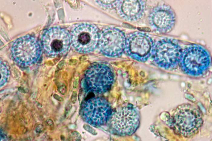 macrostoma
