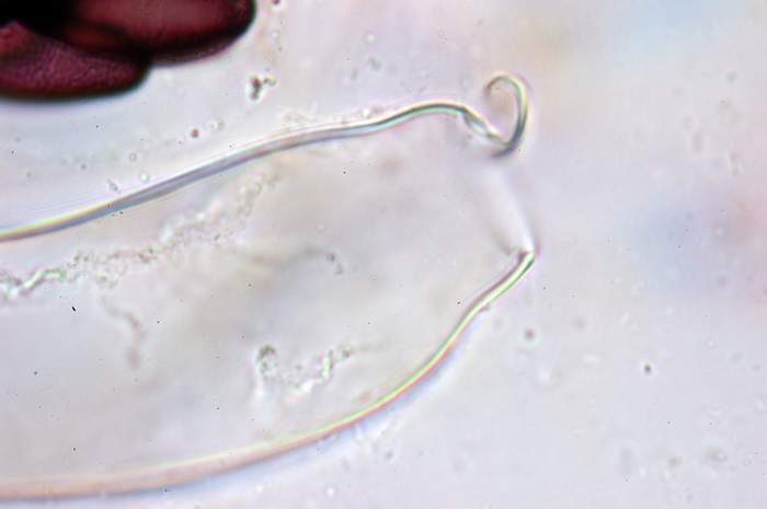 macrostoma