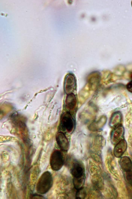 macrostoma