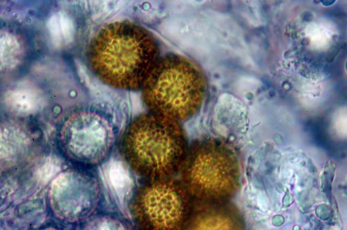 macrostoma