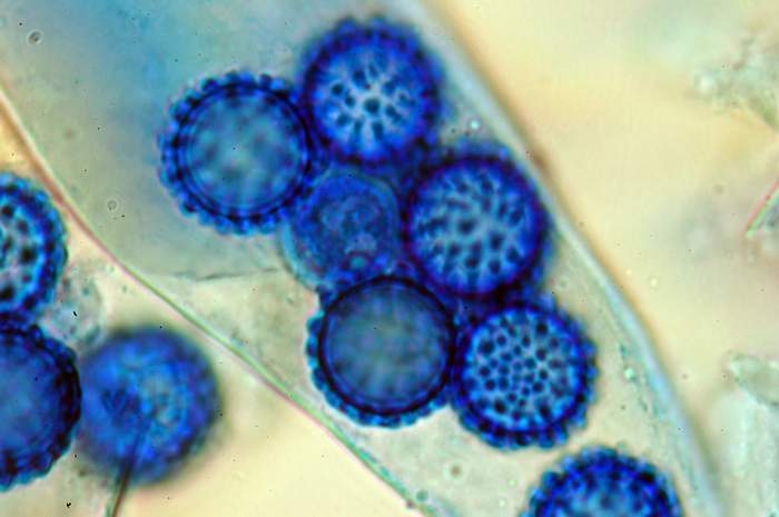 macrostoma