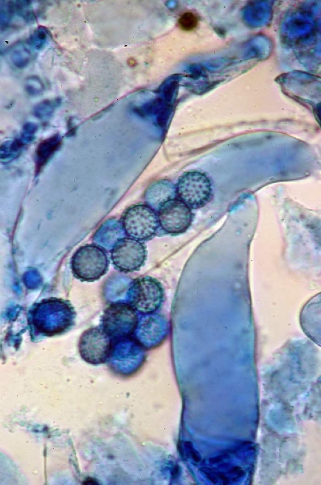 macrostoma