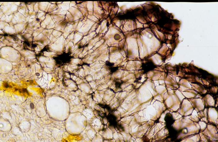 macrostoma