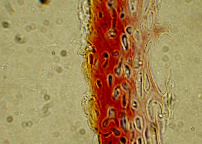 macrostoma