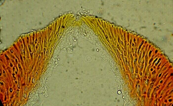 macrostoma