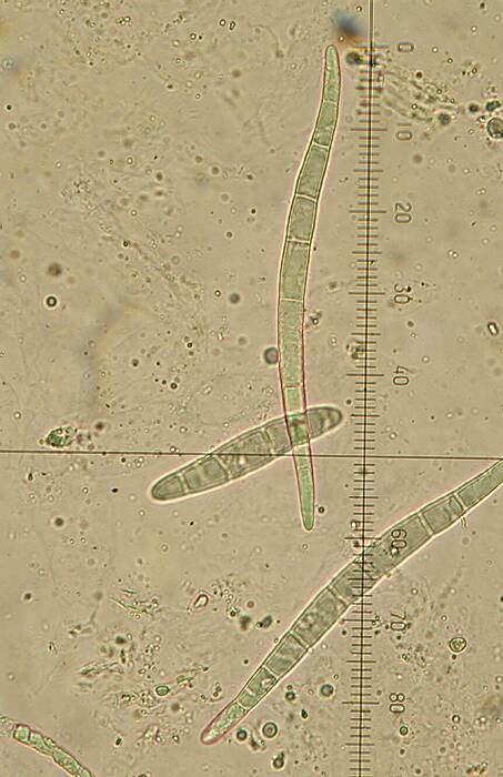 macrostoma