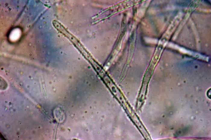 macrostoma