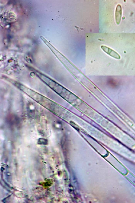 macrostoma
