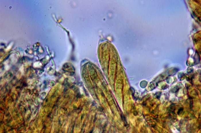 macrostoma