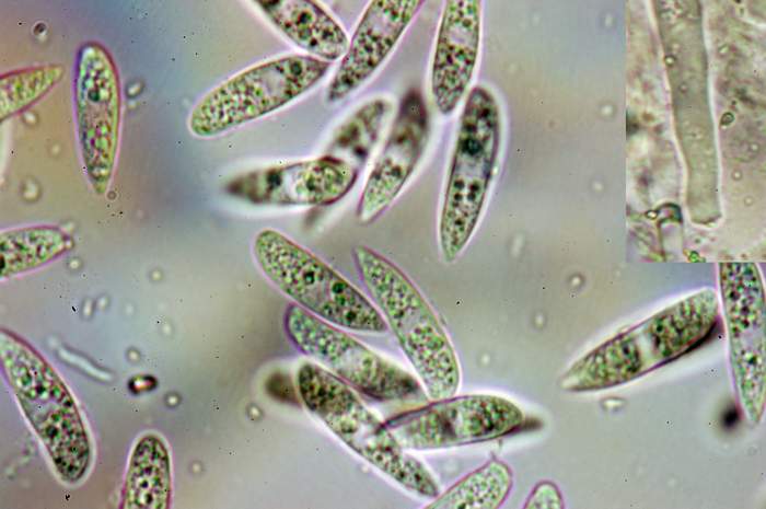 macrostoma