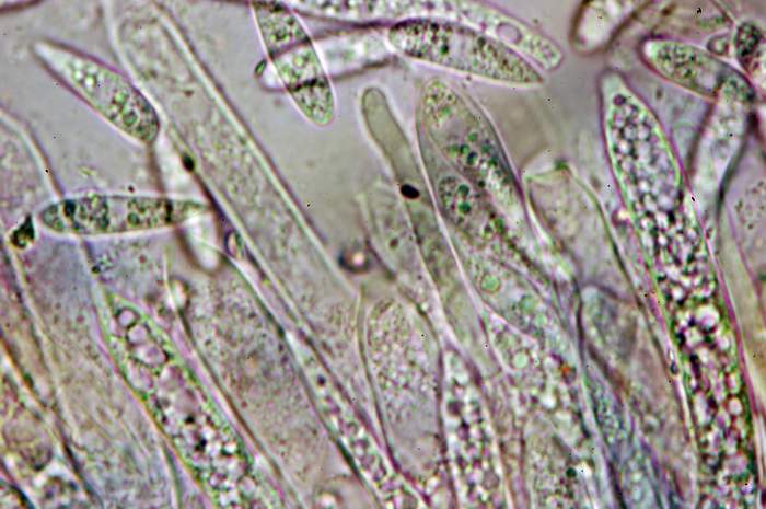 macrostoma