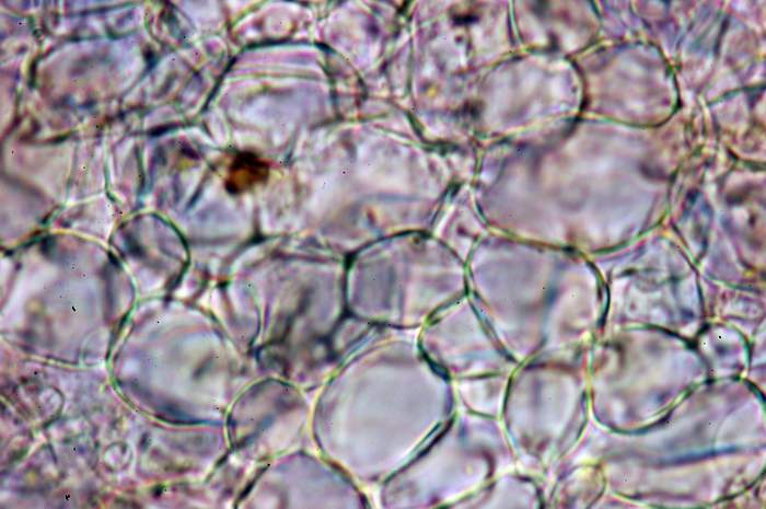 macrostoma