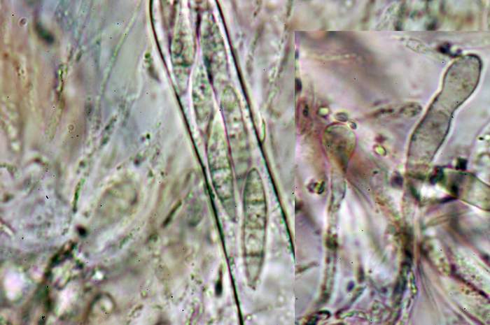 macrostoma